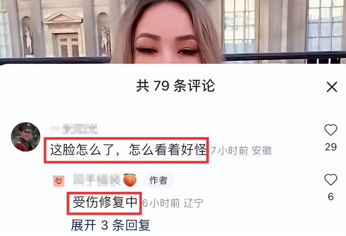 蕭亞軒受邀時裝周看秀，腳部受傷拄拐杖出席，被狗咬傷臉部變化大，網友直呼：鼻子嘴巴怪怪的