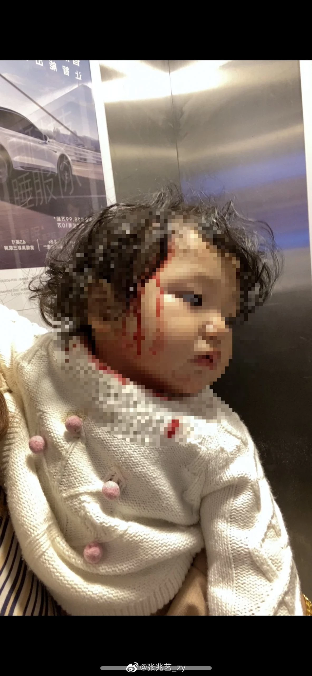中國女星「浴室玻璃門」突然爆炸⚡1歲女兒被炸到滿臉血！老公也破相！