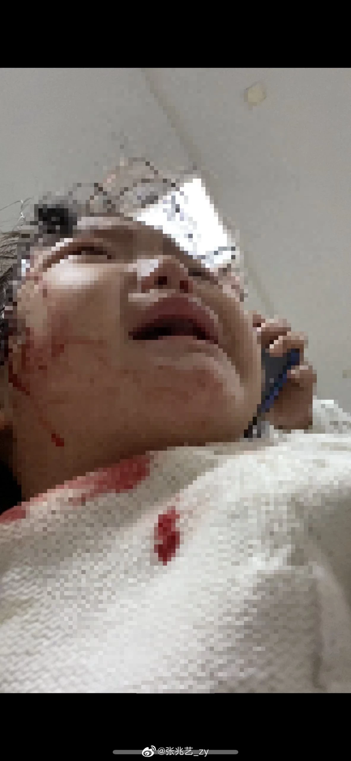 中國女星「浴室玻璃門」突然爆炸⚡1歲女兒被炸到滿臉血！老公也破相！