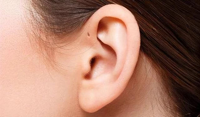 民間說法：耳朵上有「聰明孔」的人，比其他人聰明？你可能不知道