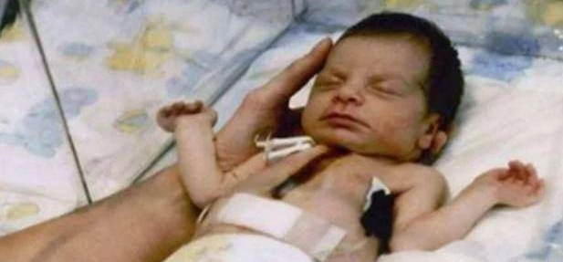 36年前女嬰為活命！一出生就移植了「狒狒的心臟」　成功活下來後「後續曝光」  
