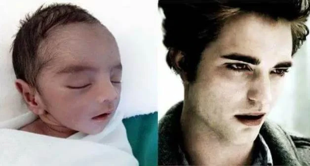世界上最帥早產兒！男嬰一出生就有張「明星臉」，2歲近照曝光，網贊：帥到令人著迷~